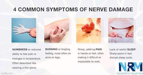Neuropatía sensorial -Síntomas de daño nervioso