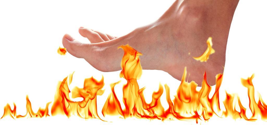 Peripheral Neuropathy Symptoms- Burning pain radiating in hands or feet