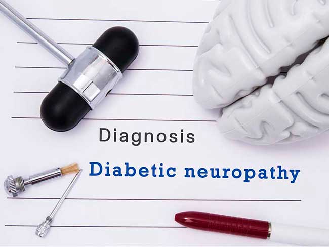 Neuropatía diabética - ¿Qué es la neuropatía diabética?