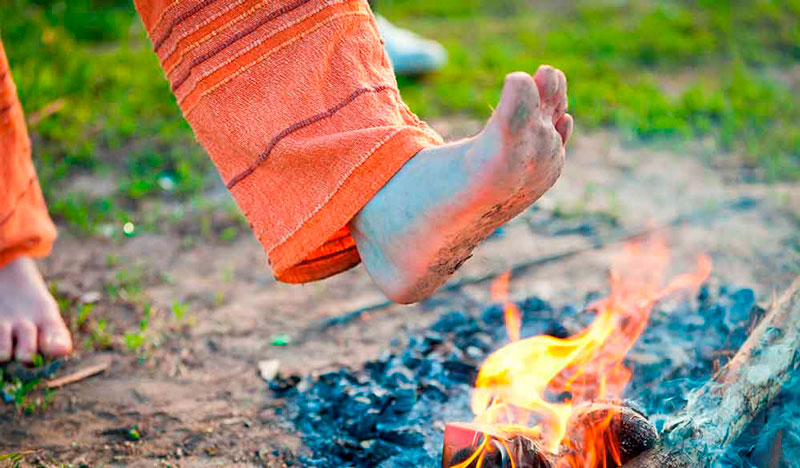 Burning Feet - Symptom of Peripheral Neuropathy