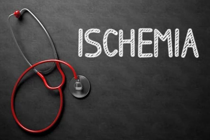Ischemia? The Major Cause Of Peripheral Neuropathy?Health nerves receive oxygenated blood and nutrition through microscopic capillaries