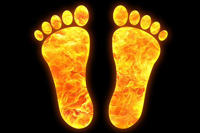 Neuropathy Relief Center of Miami: Burning Feet and Peripheral Neuropathy? Peripheral neuropathy is the most common cause of people experiencing burning feet symptoms.
