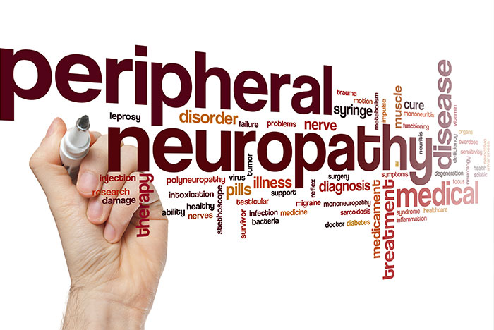 Neuropathy Relief Miami. The Prevalence of Peripheral Neuropathy in the United States.Peripheral neuropathy is a condition that affects millions of people in the United States