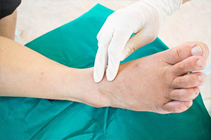 Neuropathy Relief Miami. The Prevalence of Peripheral Neuropathy in the United States. Symptoms of peripheral neuropathy can vary widely depending on the type and severity of the condition.