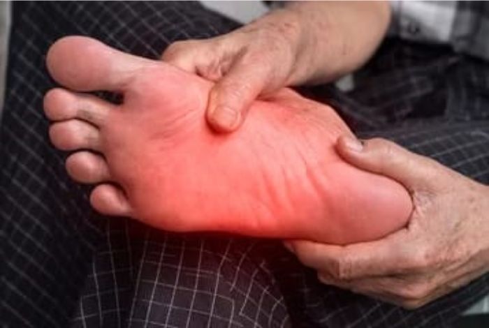 Neuropathy Relief Miami. Diabetic Peripheral Neuropathy: What You Need to Know. Diabetic peripheral neuropathy (DPN) is a type of nerve damage that can occur in people with diabetes.